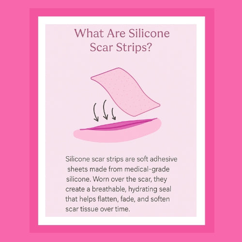 infographic of scar strips 